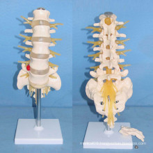 Human Natural Lumbar with Cauda Equina Medical Anatomical Model (R020709)